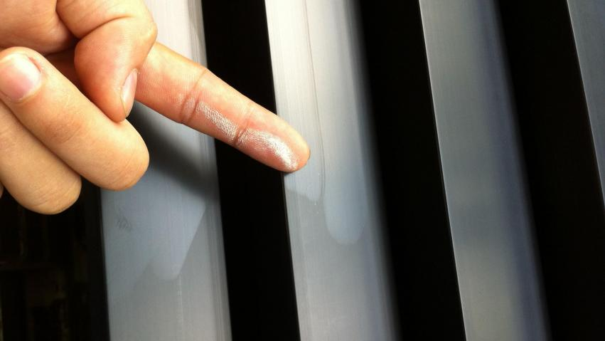 Can die-cast aluminum be anodized? 1